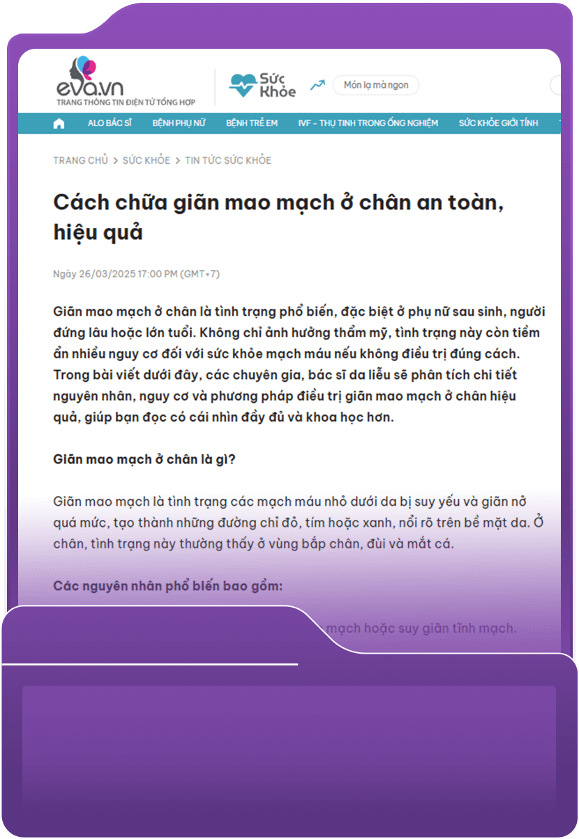 Cách chữa giãn mao mạch ở chân an toàn, hiệu quả