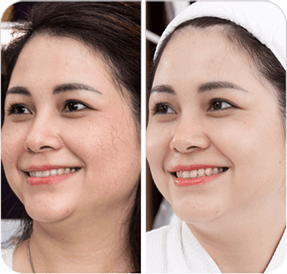 Lạm dụng kem bôi