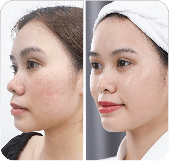 Tác động môi trường