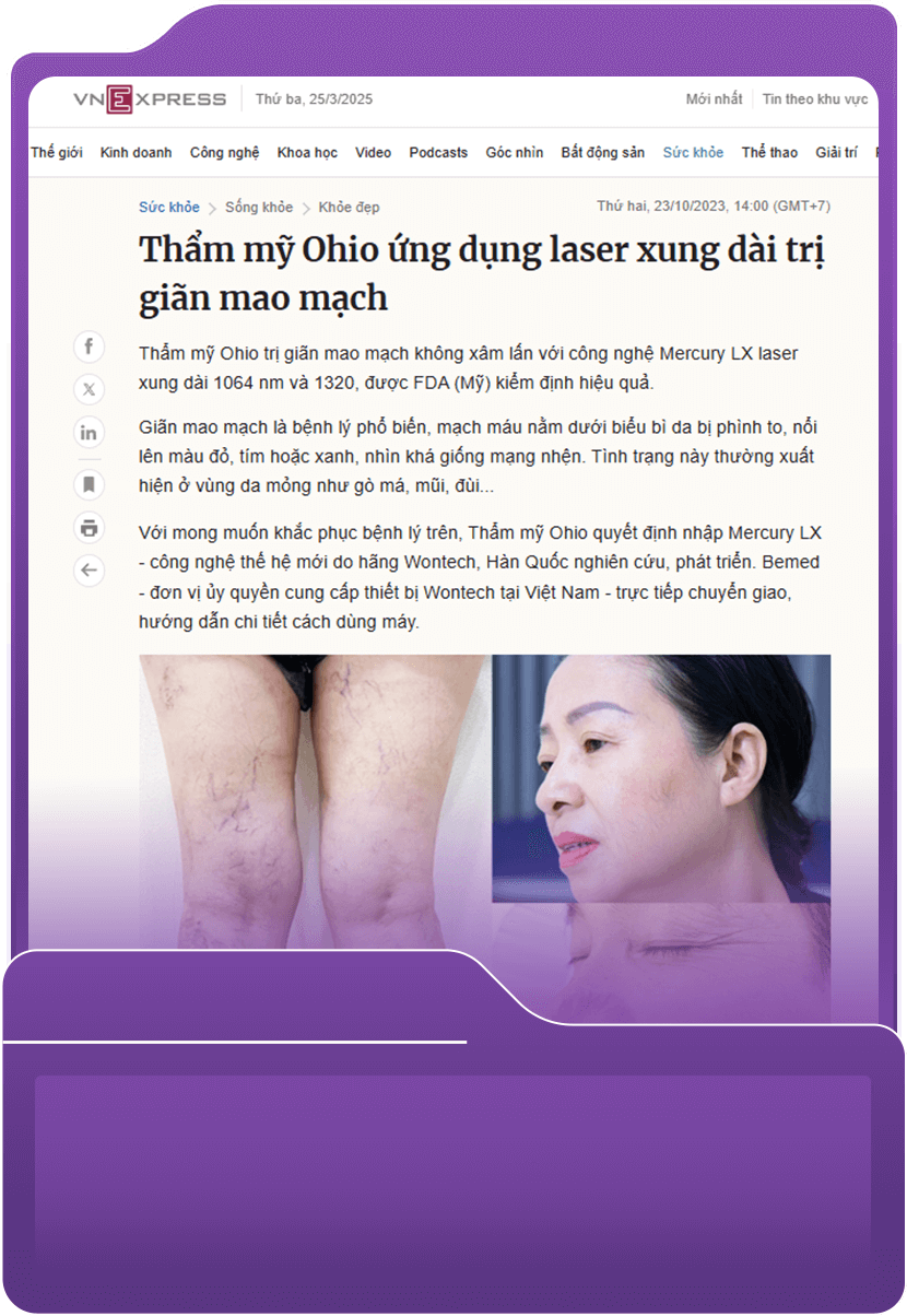 Thẩm mỹ Ohio ứng dụng laser xung dài trị giãn mao mạch