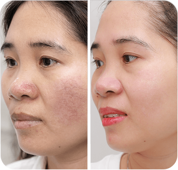 Các bệnh lý da liễu