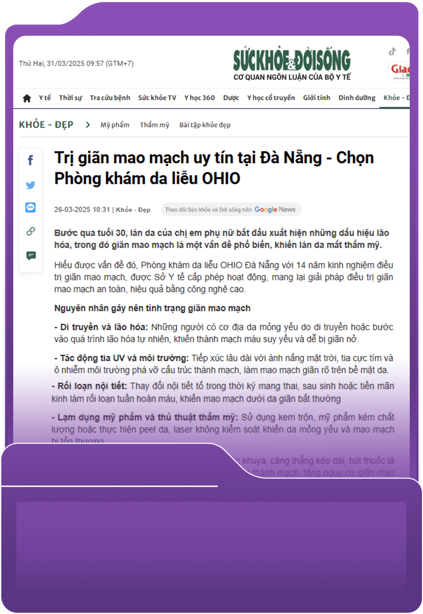 Trị giãn mao mạch uy tín tại Đà Nẵng - Chọn Phòng khám Da liễu OHIO