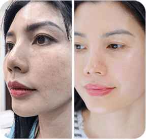 Di truyền, bẩm sinh